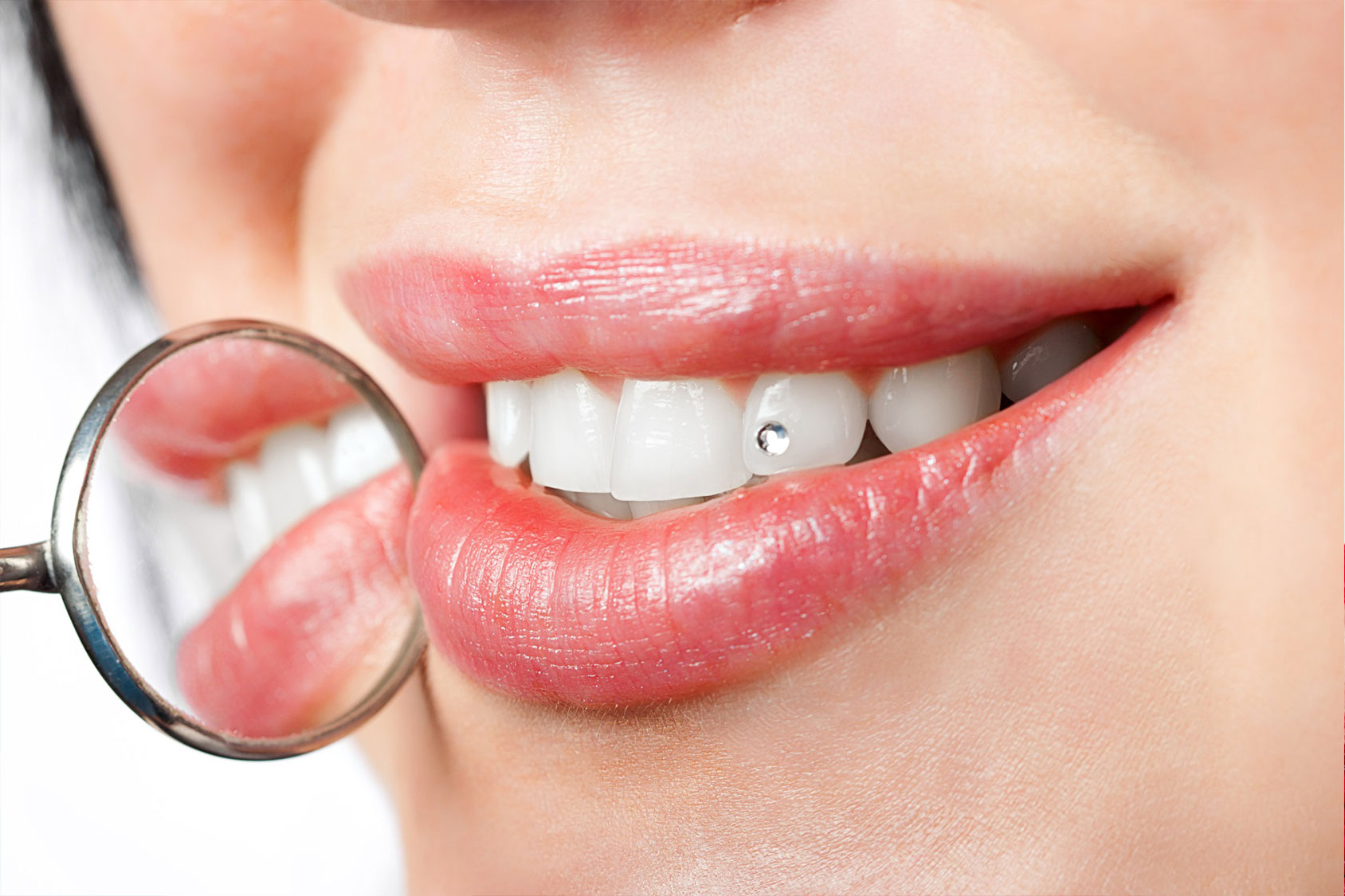 1 Brillantino applicazione (a dente) - Gruppo Oris, Dentista