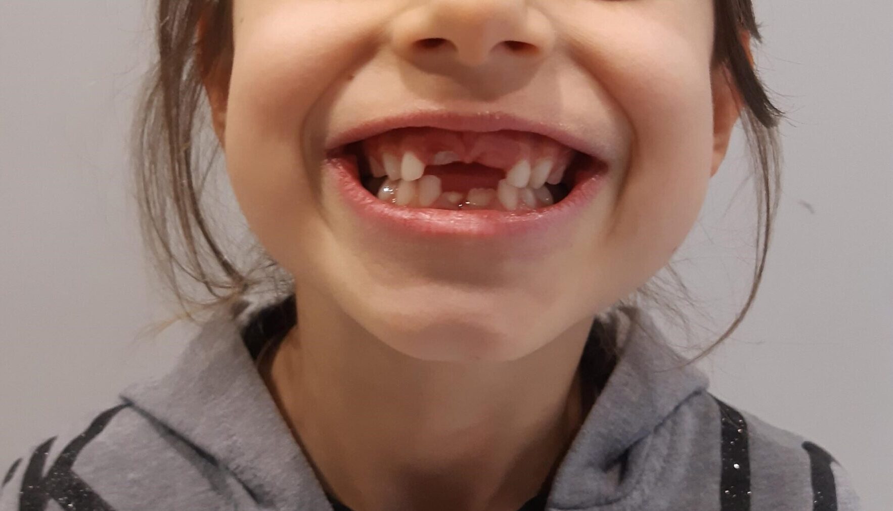 Per il sorriso del tuo bambino ci vuole un dentista speciale